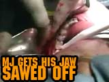 MJ Gets his JAW SAWED OFF